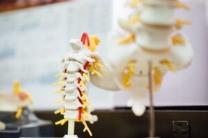 model of the spine for cauda equina syndrome