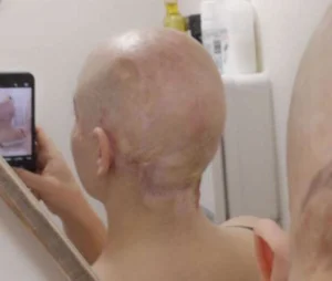 life changing injuries