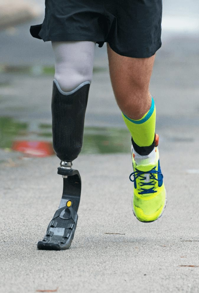 man running with prosthetic leg