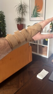 broken arm - elliot lime case