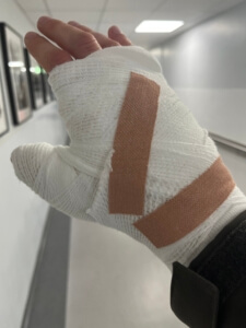 broken hand - elliot lime case
